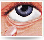 頭仰后，用食指將下眼瞼下拉，使其成袋狀