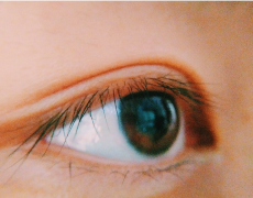 倒睫是由什么原因引起的？