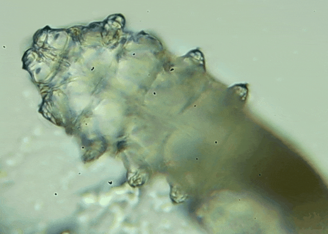 睫毛上驚現(xiàn)80只螨蟲！別揉了，快自查下你的眼睛有沒有......