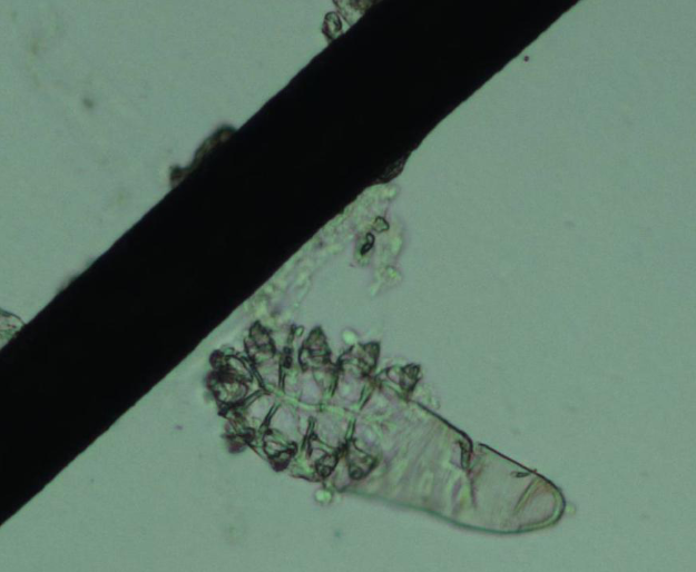 螨蟲(chóng)篩查